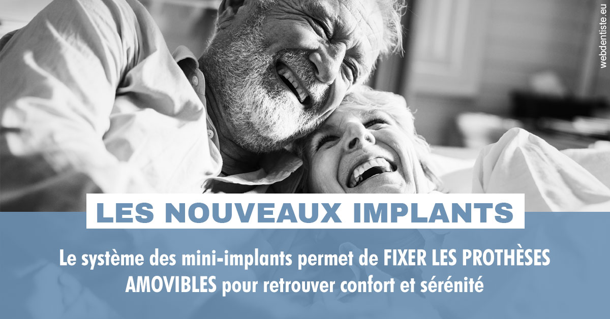 https://scp-stricker-rozensztajn-doux.chirurgiens-dentistes.fr/Les nouveaux implants 2