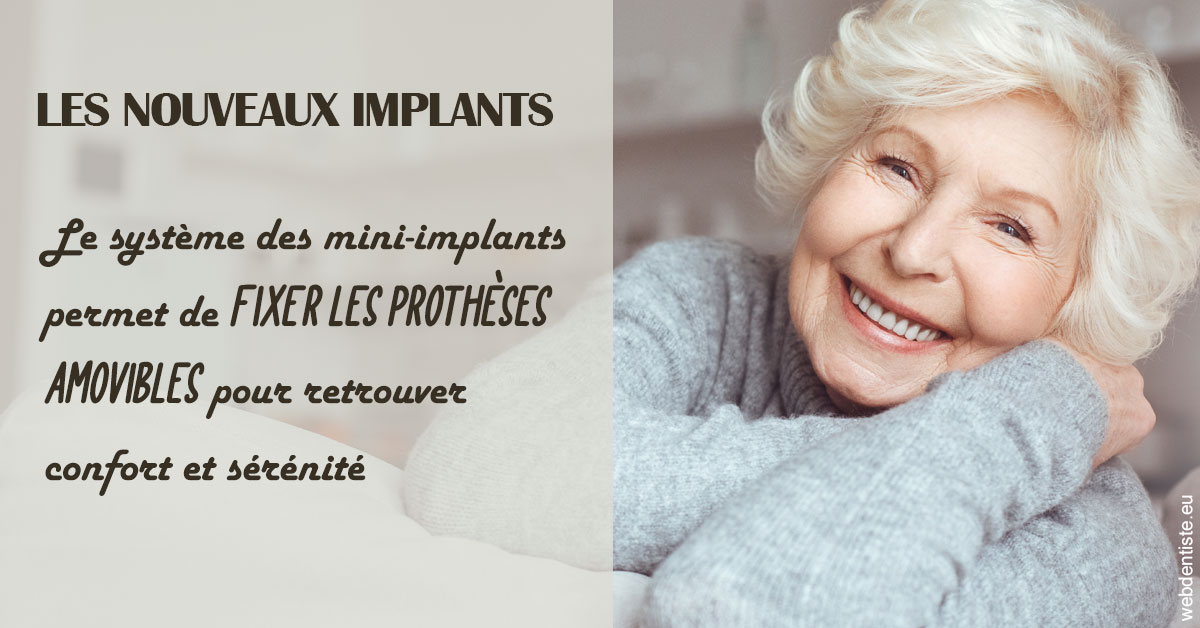 https://scp-stricker-rozensztajn-doux.chirurgiens-dentistes.fr/Les nouveaux implants 1