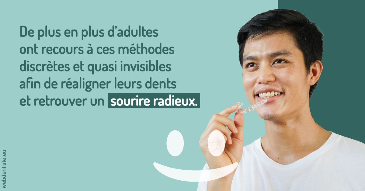 https://scp-stricker-rozensztajn-doux.chirurgiens-dentistes.fr/Gouttières sourire radieux 2