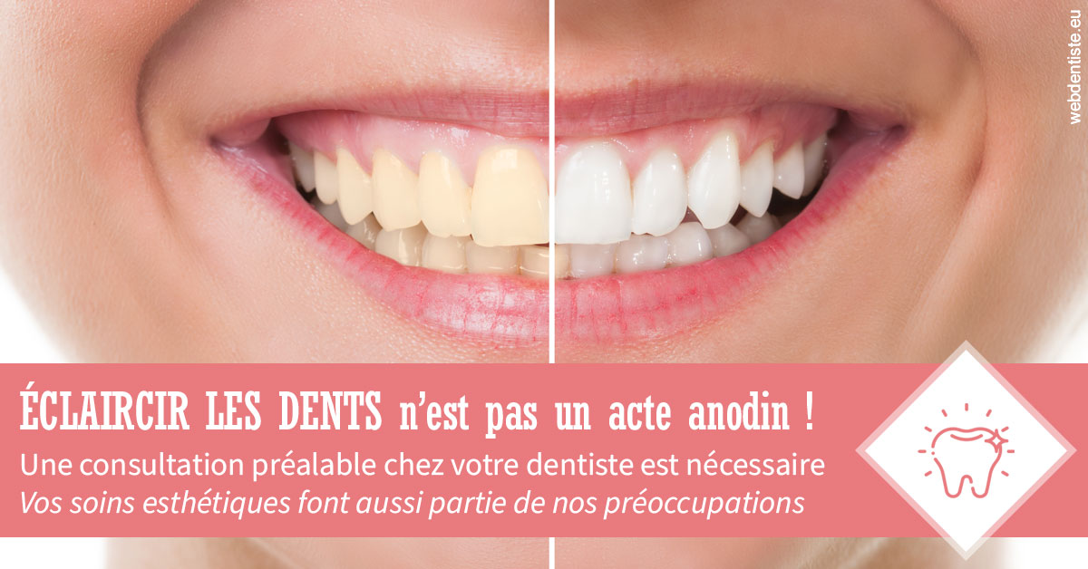 https://scp-stricker-rozensztajn-doux.chirurgiens-dentistes.fr/Eclaircir les dents 1