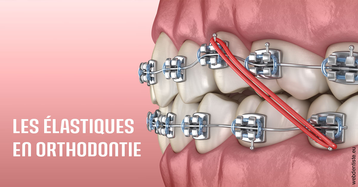 https://scp-stricker-rozensztajn-doux.chirurgiens-dentistes.fr/Elastiques orthodontie 2