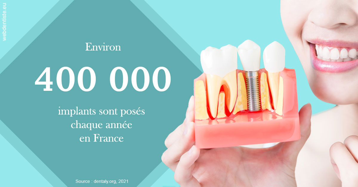 https://scp-stricker-rozensztajn-doux.chirurgiens-dentistes.fr/Pose d'implants en France 2